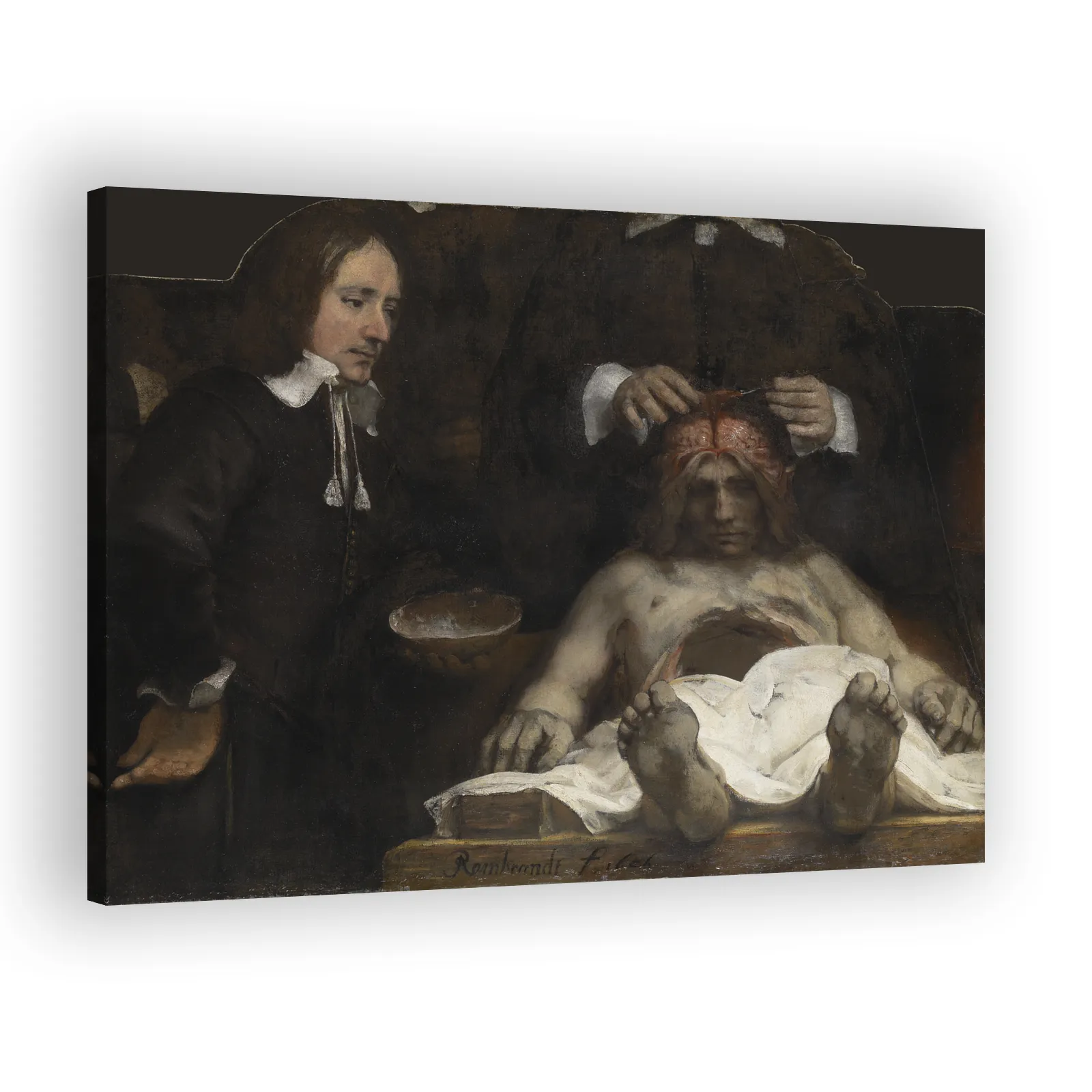 The Anatomy Lesson of Dr. Jan Deyman by Rembrandt Van Rijn - view 2 thumbnail