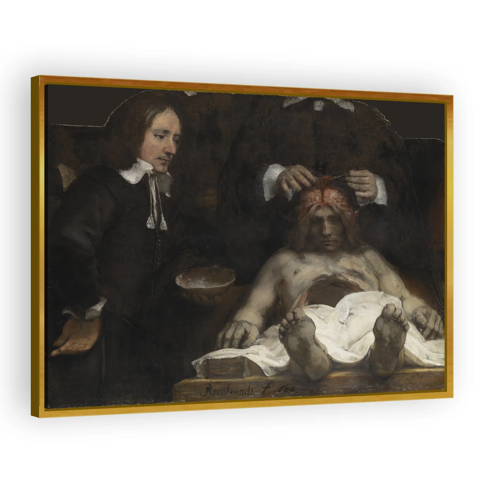 The Anatomy Lesson of Dr. Jan Deyman by Rembrandt Van Rijn - view 3 thumbnail