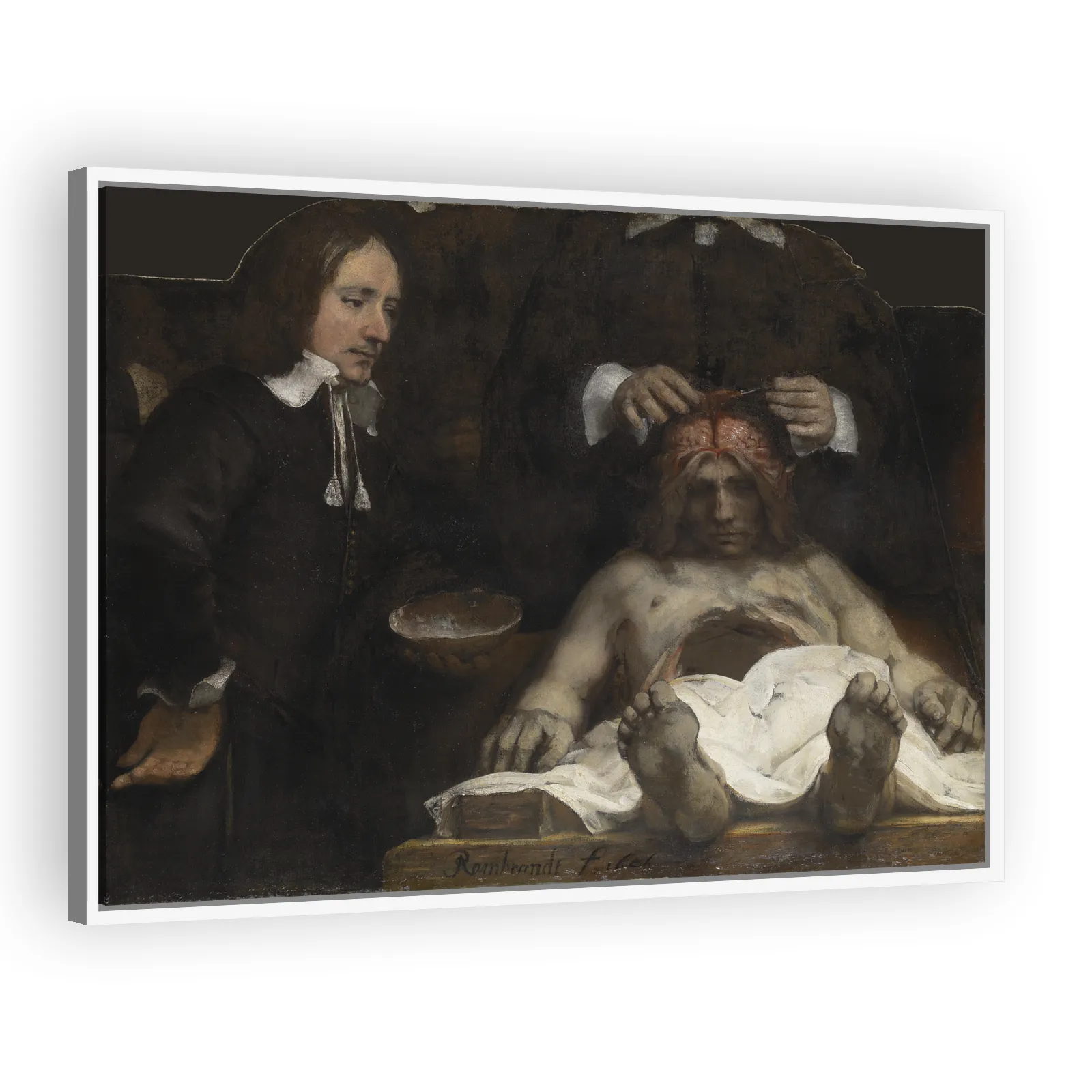 The Anatomy Lesson of Dr. Jan Deyman by Rembrandt Van Rijn - view 5 thumbnail