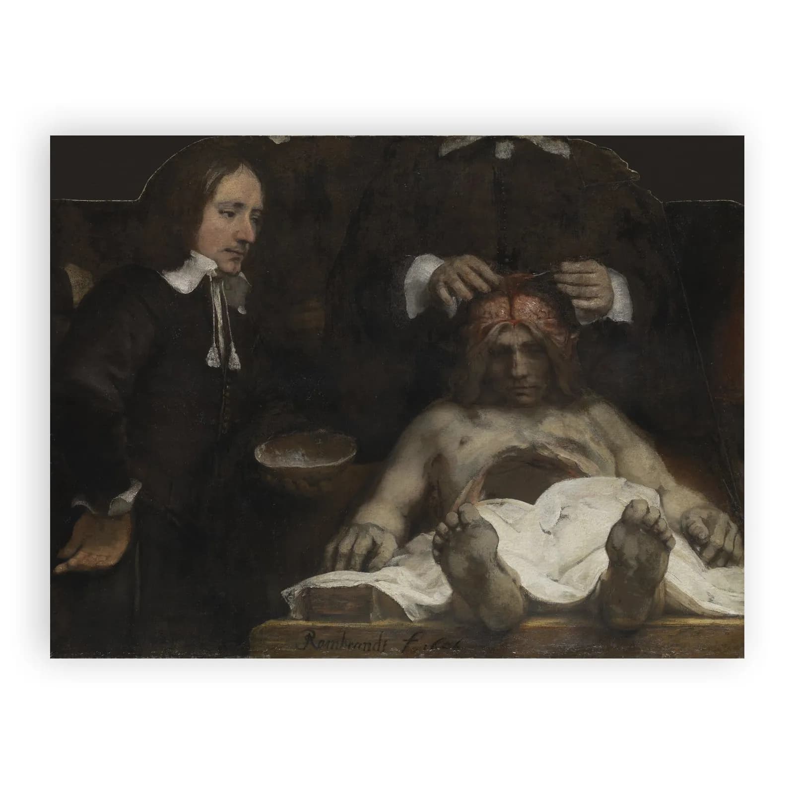 The Anatomy Lesson of Dr. Jan Deyman by Rembrandt Van Rijn - view 6 thumbnail
