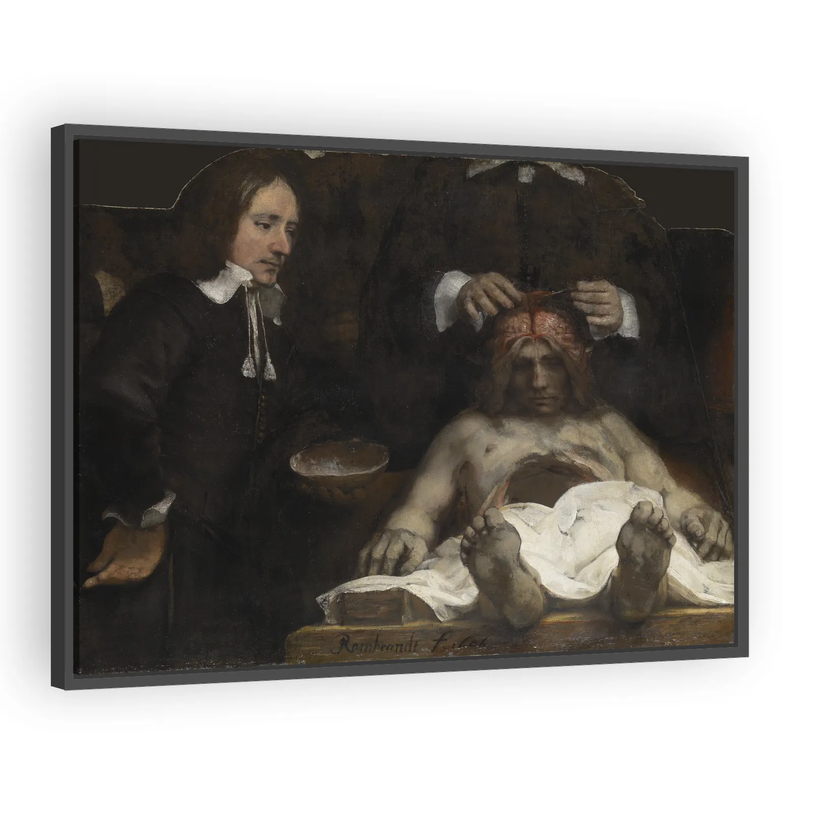 The Anatomy Lesson of Dr. Jan Deyman by Rembrandt Van Rijn